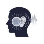 Meniere's Disease: Understanding the Inner Ear's Unpredictable Storm